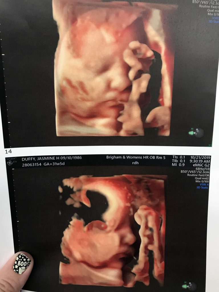 3rd Pregnancy: 31 Weeks 5 Days.